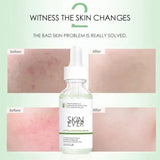 Skin Ever Centella Soothing Serum - 30ml