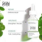 Skin Ever Centella Soothing Serum - 30ml