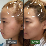 Some By Mi Cica Peptide Anti Hair Loss Derma Scalp Tonic - 150ml